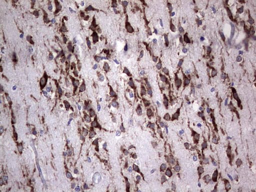 ANO1 / DOG1 / TMEM16A Antibody (aa1-333, clone OTI1C8, Carrier-free)