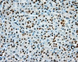 PKG / PRKG1 Antibody (clone OTI9G4)