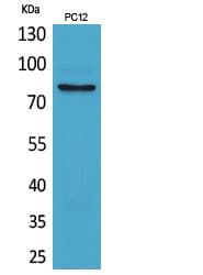 Polyclonal Rabbit anti-Human BCAM / CD239 Antibody (WB)