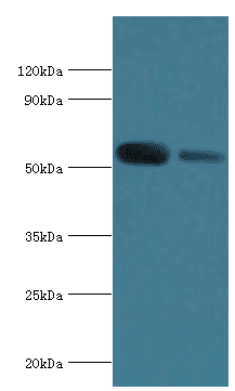 IHC-plus™ Polyclonal Rabbit anti-Human ATP6V1B1 Antibody (aa1-280, IHC, WB)