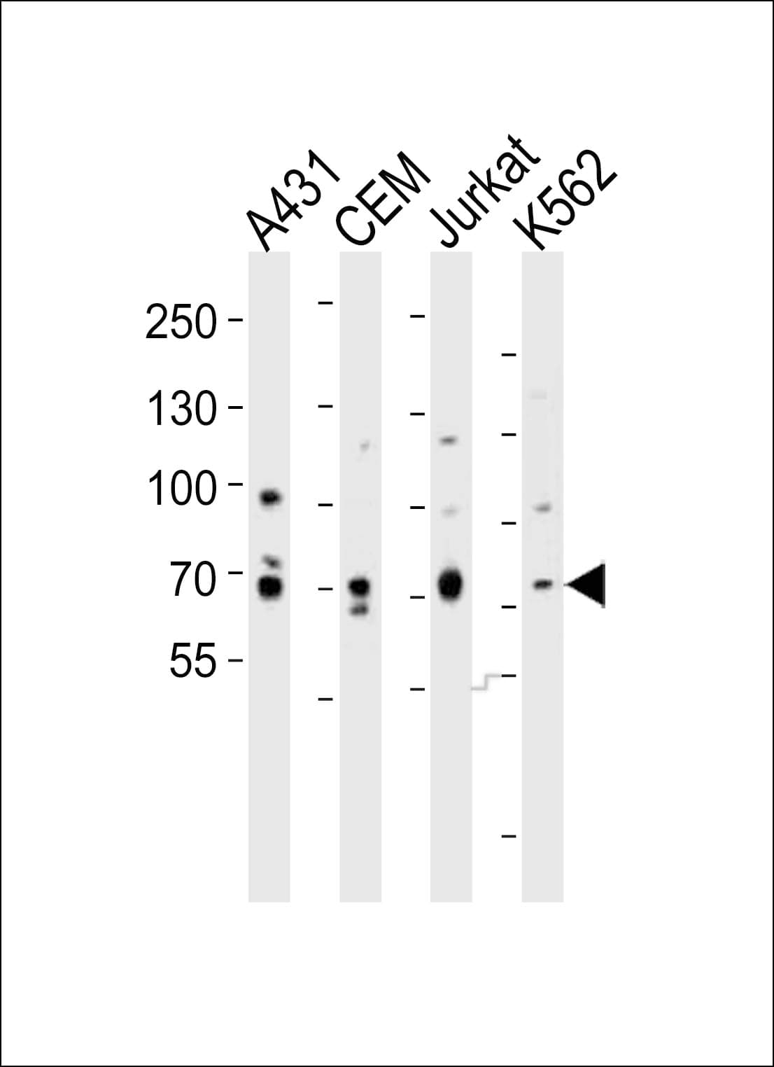 ITK / EMT Antibody (aa228-262)