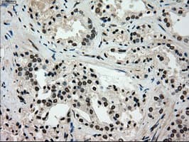 Monoclonal Mouse anti-Human GCK / Glucokinase Antibody (clone OTI3E3, IHC, IF, WB)