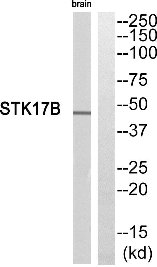 STK17B / DRAK2 Antibody