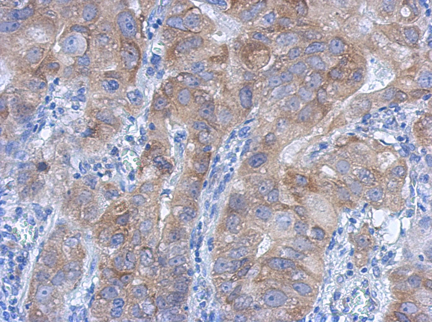 IKBKB / IKK2 / IKK Beta Antibody (aa493-739)