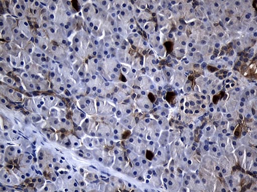 RRM2 Antibody (clone OTI3D3)