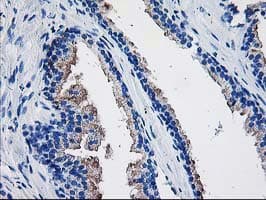 TBC1D21 Antibody (clone OTI6F9)