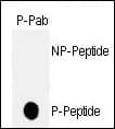 TP53 / p53 Antibody (phospho-Thr18)