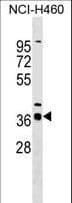 Polyclonal Rabbit anti-Human SERTAD2 Antibody (aa1-30, WB)