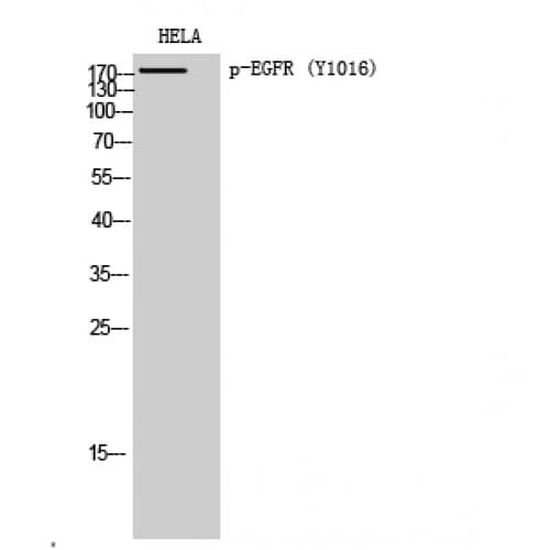 EGFR Antibody (960-1040 aa)