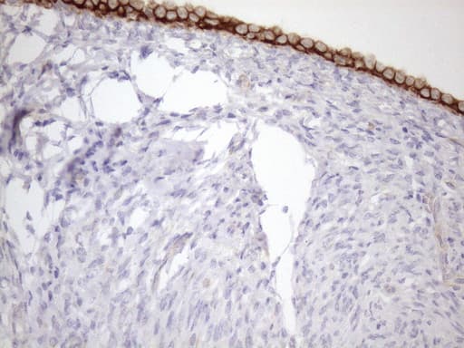 KRT18 / CK18 / Cytokeratin 18 Antibody (aa69-372, clone OTI3D1)