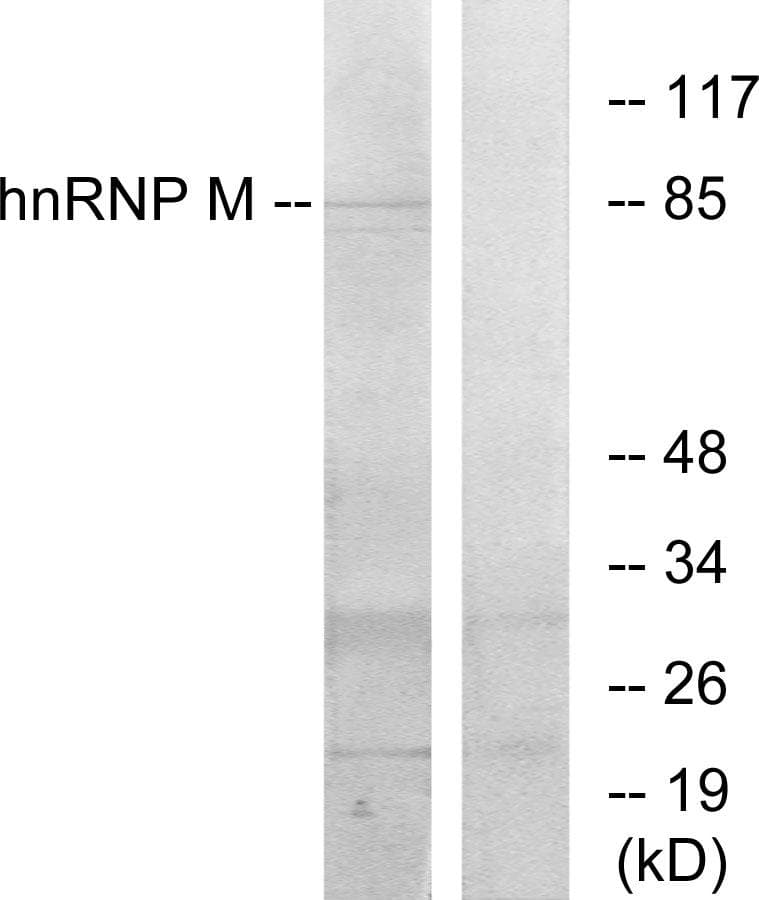 Polyclonal Rabbit anti-Human HNRPM / HNRNPM Antibody (IHC, IF, WB)