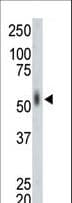 MKNK2 / MNK2 Antibody (aa70-100)