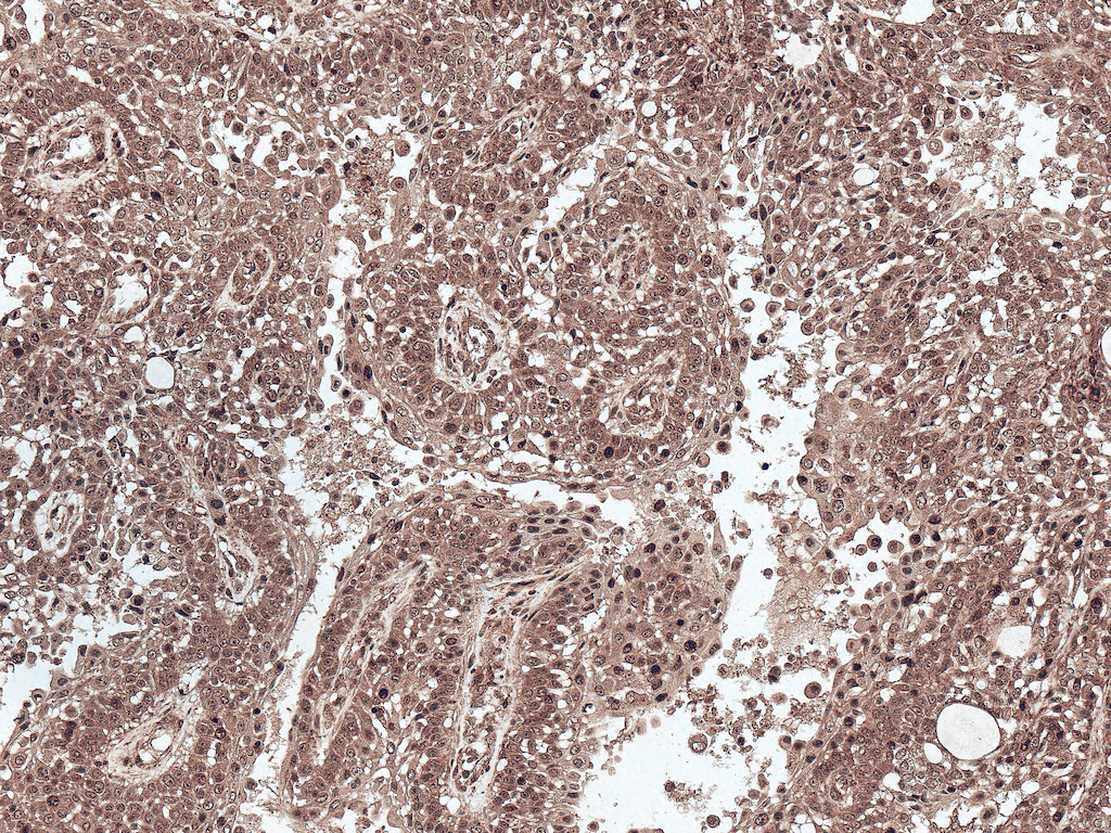 PSEN1 / Presenilin 1 Antibody