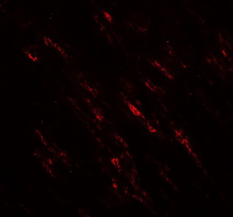 Polyclonal Rabbit anti-Human POU2F3 / PLA-1 Antibody (IHC, IF, WB)
