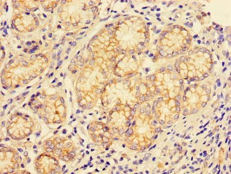 CTSE / Cathepsin E Antibody