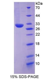 Rat PXN / Paxillin Protein (Recombinant His-T7)