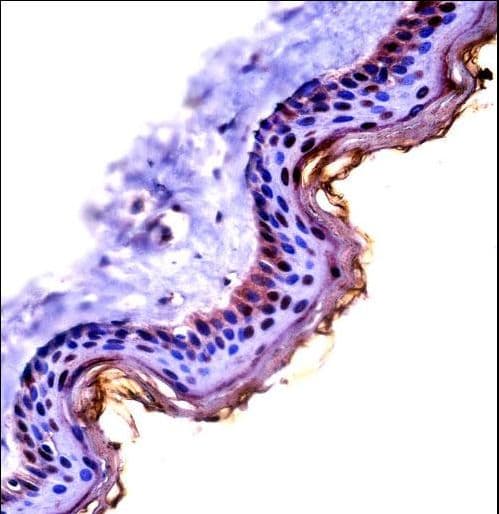 CSTA / Cystatin A Antibody (aa69-98)