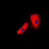 Polyclonal Rabbit anti-Human JUP/CTNNG/Junction Plakoglobin Antibody (C-Terminus, IHC, IF, WB)