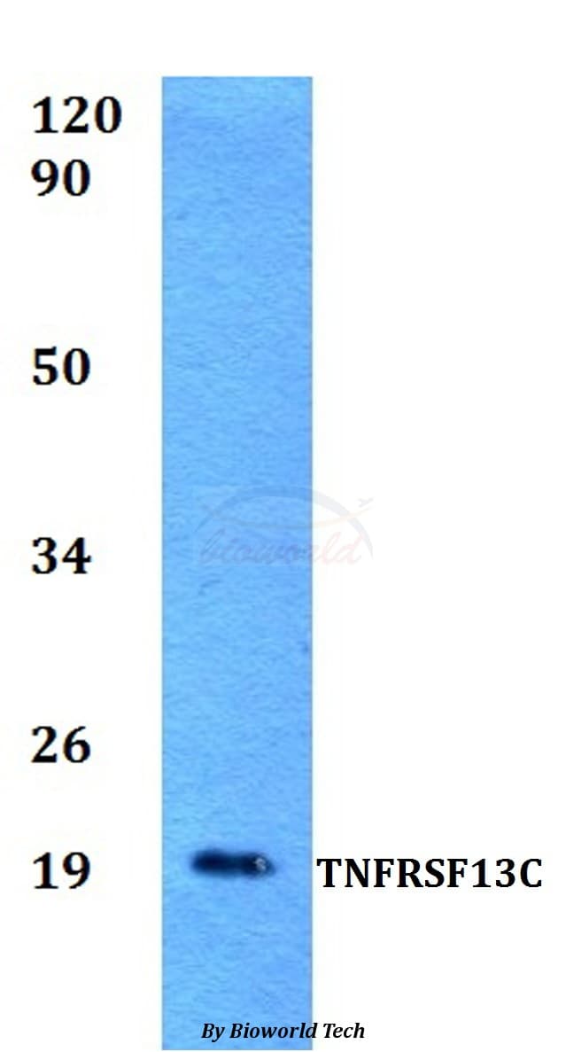 BAFF Receptor / CD268 Antibody