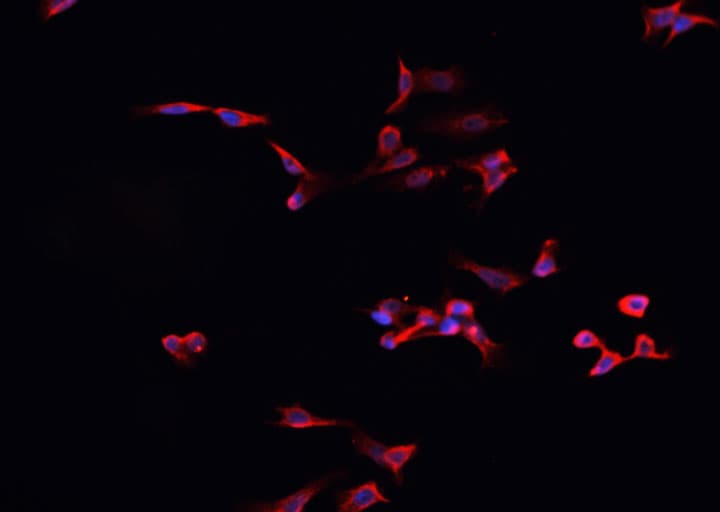 ALK3 / BMPR1A Antibody