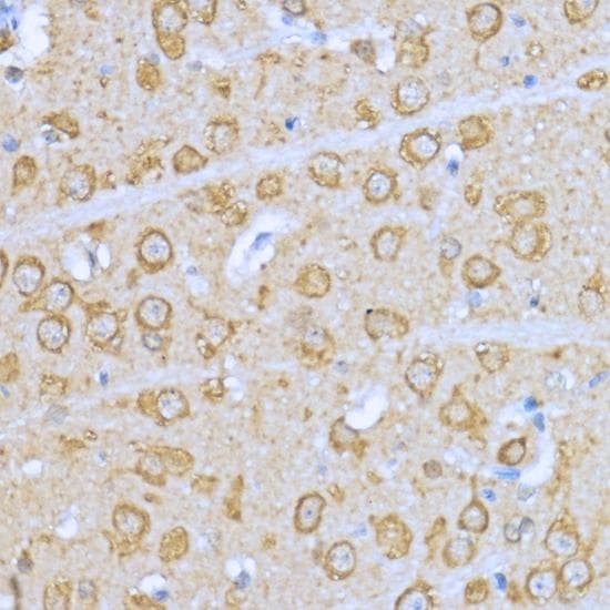 HSP90AA1 / Hsp90 Alpha A1 Antibody