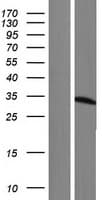 Human ETFA Protein (Over-Expression Lysate Myc-DDK (Flag))