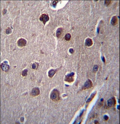 KCTD10 Antibody (aa273-301)