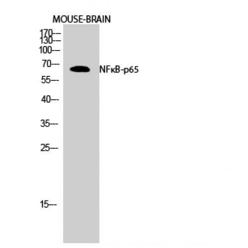 RELA / NFKB p65 Antibody (250-330 aa)