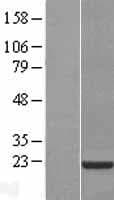 CNBP / ZNF9 Protein (Over-Expression Lysate Myc-DDK (Flag))