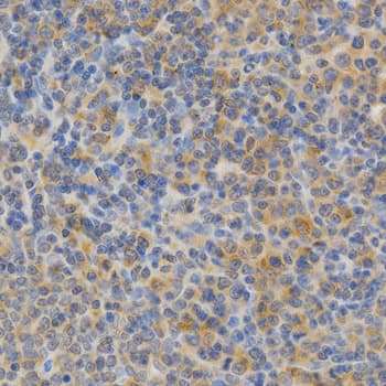 PRKCE / PKC-Epsilon Antibody