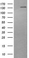 Monoclonal Mouse anti-Human ERBB2 / HER2 Antibody (clone OTI6H9, Carrier-free, aa676-1255, WB)