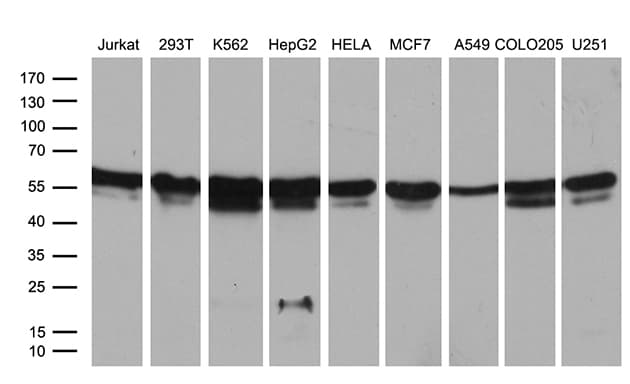 RING1 Antibody (aa88-362, clone OTI3G7, Carrier-free)