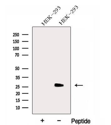 Polyclonal Rabbit anti-Human GAMT Antibody (WB)