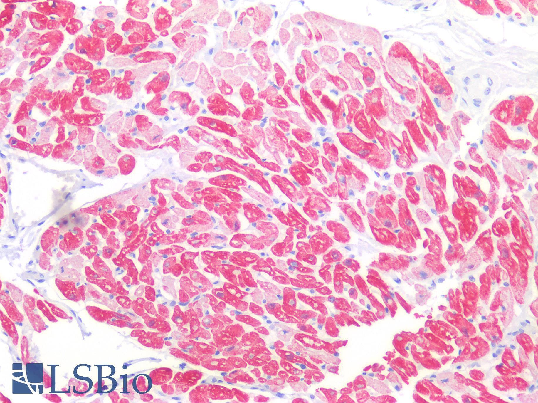 IHC-plus™ TNNI3 / Cardiac Troponin I Antibody (aa41-49)