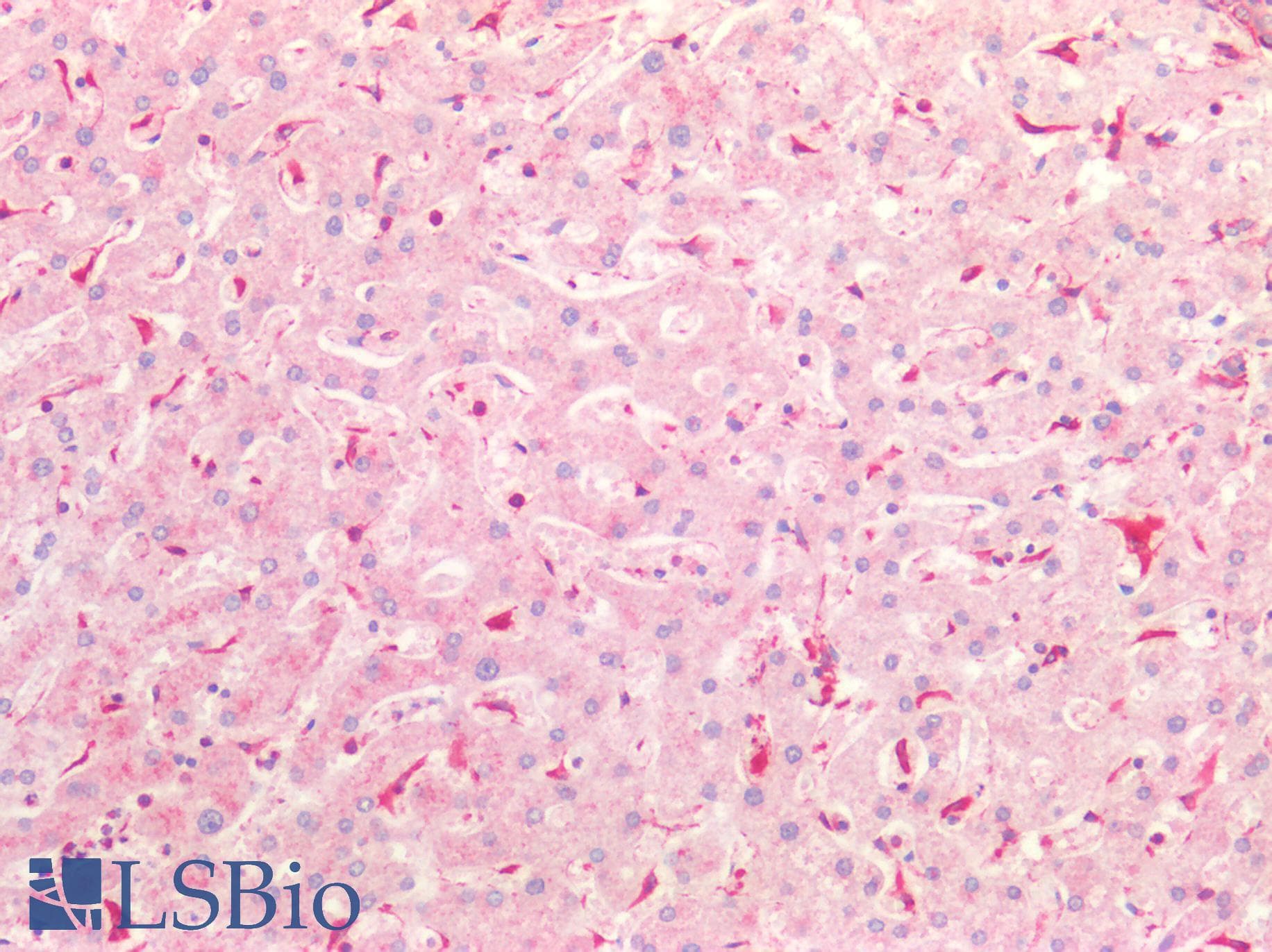 IHC-plus™ Vimentin Antibody (aa2-466)