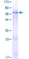 Human LRRC28 Protein (Recombinant GST)