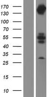 INPPL1 / SHIP2 Protein (Over-Expression Lysate Myc-DDK (Flag))