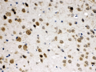 ABR Antibody