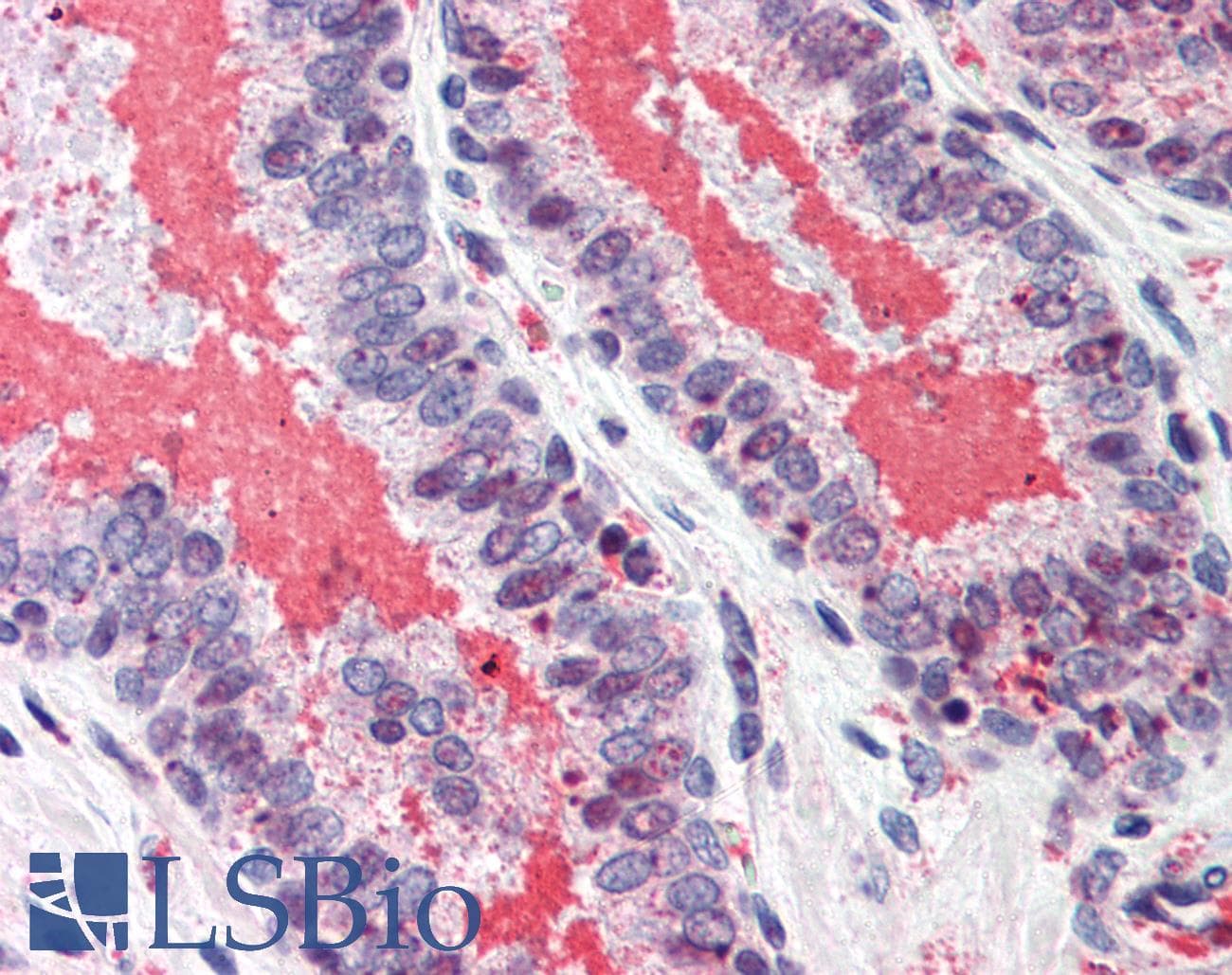 IHC-plus™ Polyclonal Rabbit anti-Human PRKDC / DNA-PKcs Antibody (phospho-Thr2609, IHC, WB)