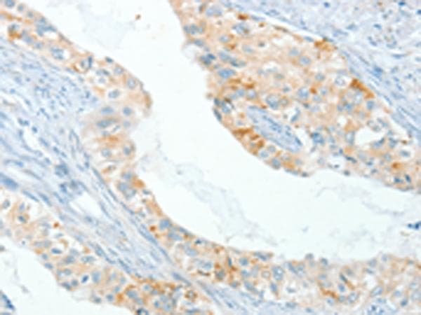 APOL2 / Apolipoprotein L 2 Antibody