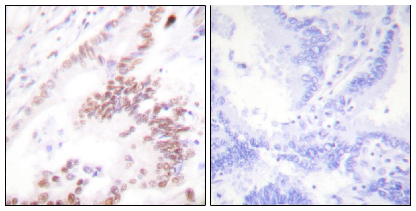 EP300 / p300 Antibody