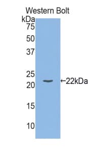 IL-1B / IL-1 Beta Antibody (aa118-269)