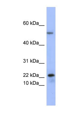 Polyclonal Rabbit anti-Human PLA2G5 Antibody (C-Terminus, WB)