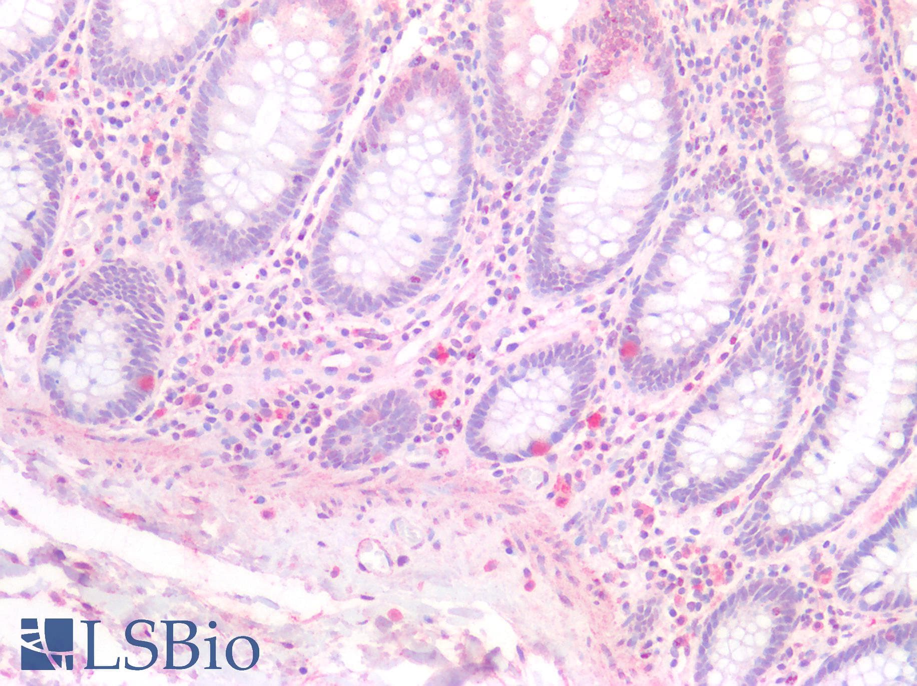 IHC-plus™ HINT / HINT1 Antibody (clone 2D7)