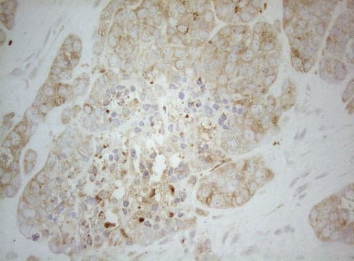 ALOX5 / 5-LOX Antibody (aa18-364, clone OTI2C5)
