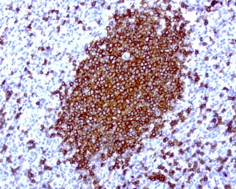 CD20 Antibody (clone UMAB39)