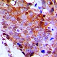 RPL13 / Ribosomal Protein L13 Antibody