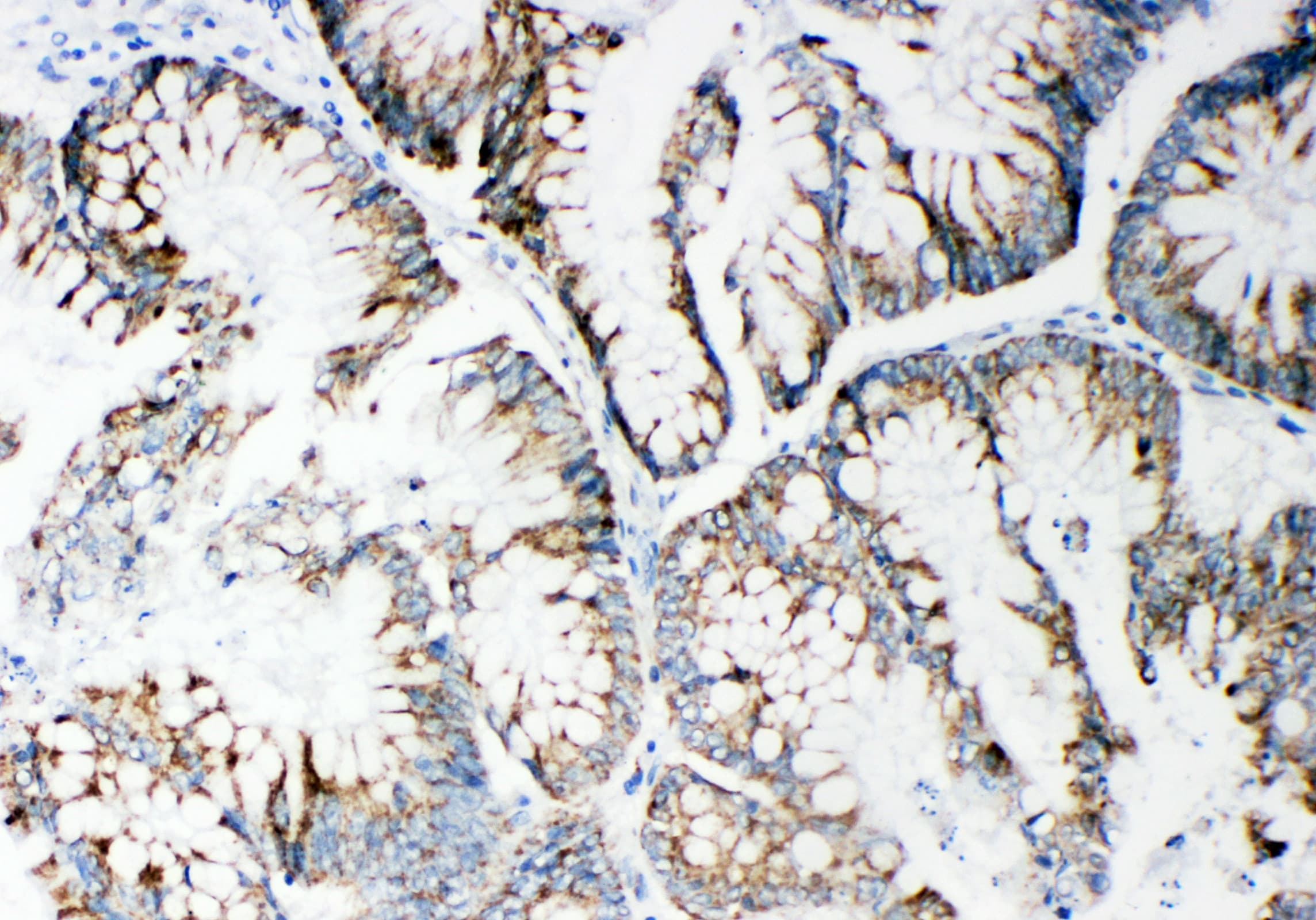 MMP14 Antibody (aa567-582)