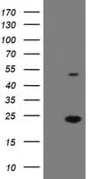 EIF5A2 Antibody (clone OTI6G7)