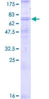 Human ADRB2 Protein (Recombinant GST)